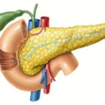 ¿Qué son las neoplasias quísticas del páncreas?