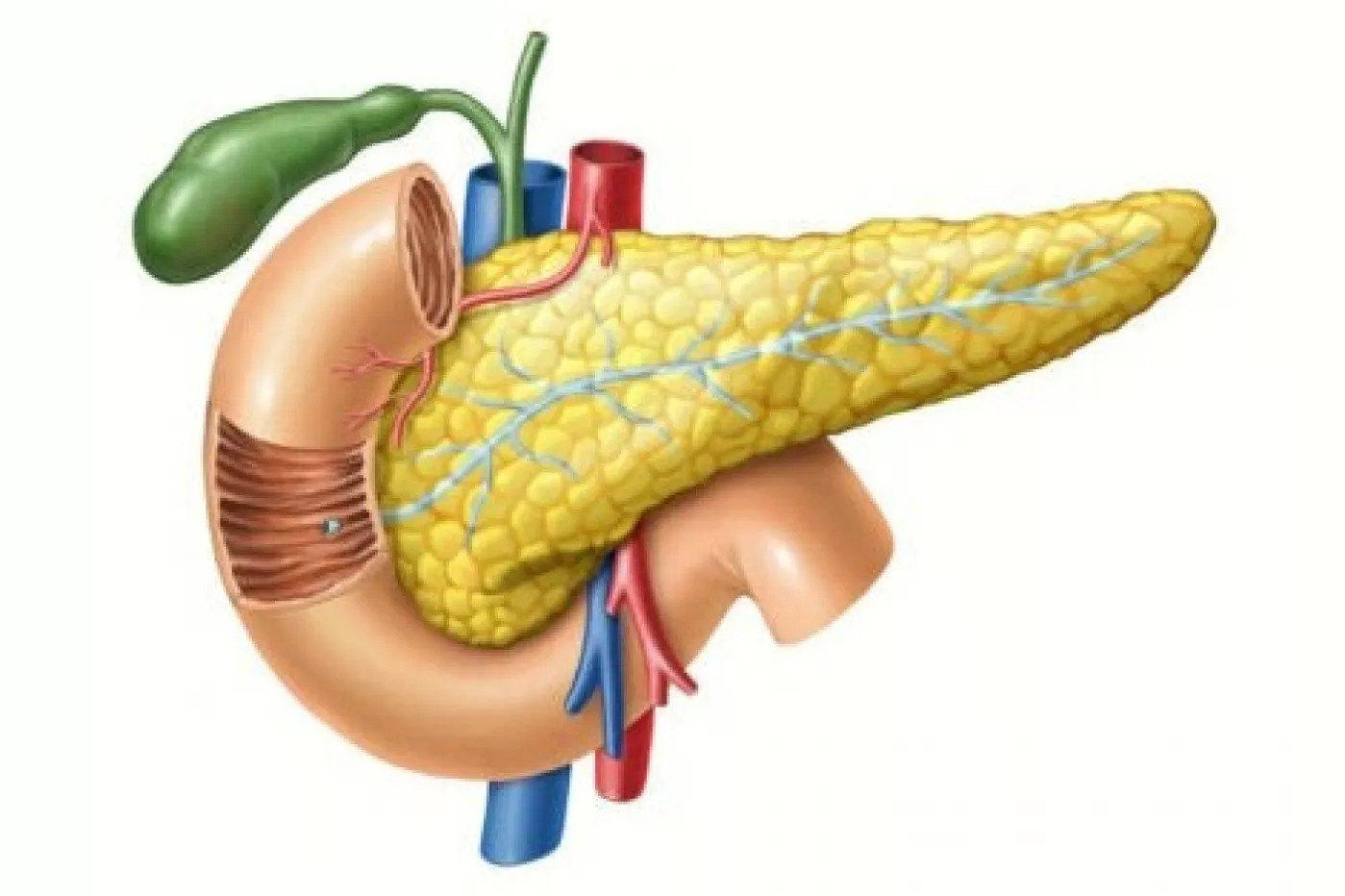 ¿Qué son las neoplasias quísticas del páncreas?