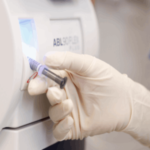 ¿Qué es la gasometría arterial?