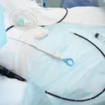 Complicaciones en procedimientos con penetración corporal.