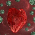 ¿Qué es la miocarditis viral aguda?