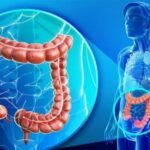 ¿Cuáles son las causas de hemorragia del tubo digestivo bajo?