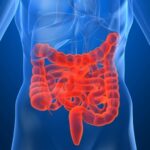 Factores genéticos y ambientales causantes de enfermedad de Crohn