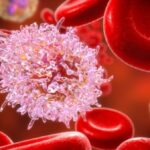 Respuesta Inflamatoria Sistémica