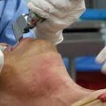 ¿Qué fármacos se pueden utilizar para realizar intubación orotraqueal?