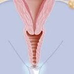 Anatomía de vagina
