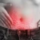¿Qué es la apendicitis aguda?
