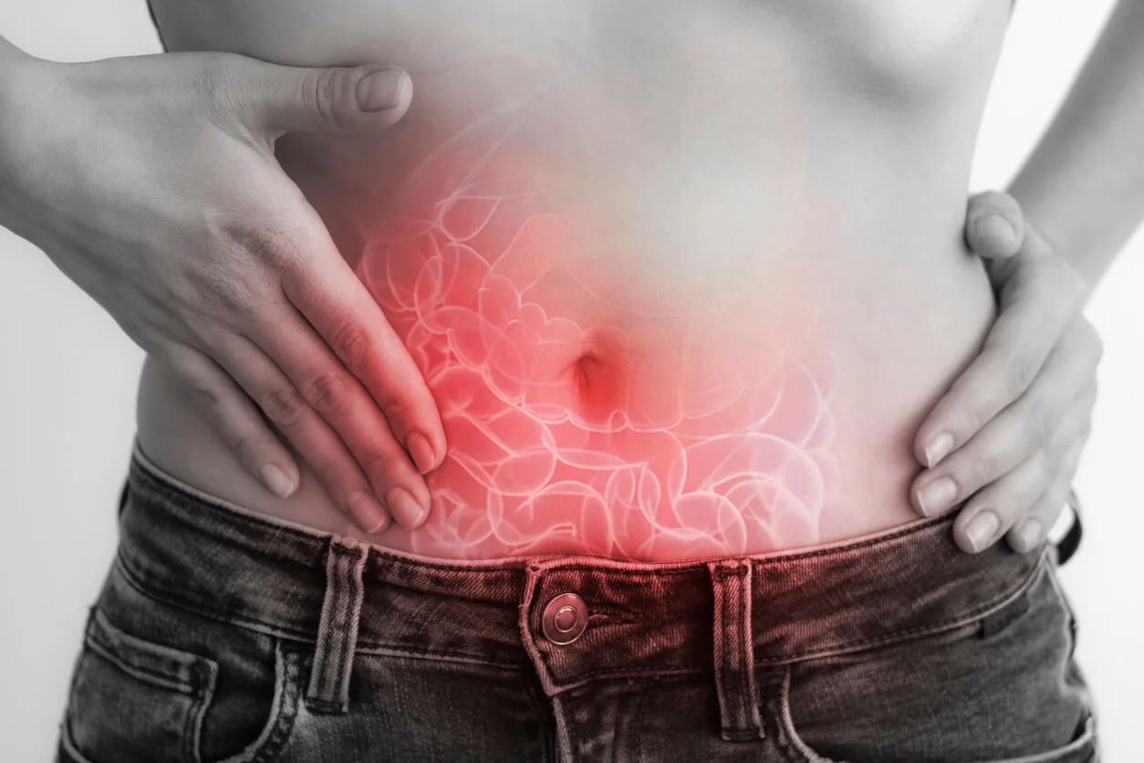 ¿Qué es la apendicitis aguda?
