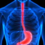¿Cuál es el manejo inicial en pacientes con sangrado del tubo digestivo por várices esofágicas?