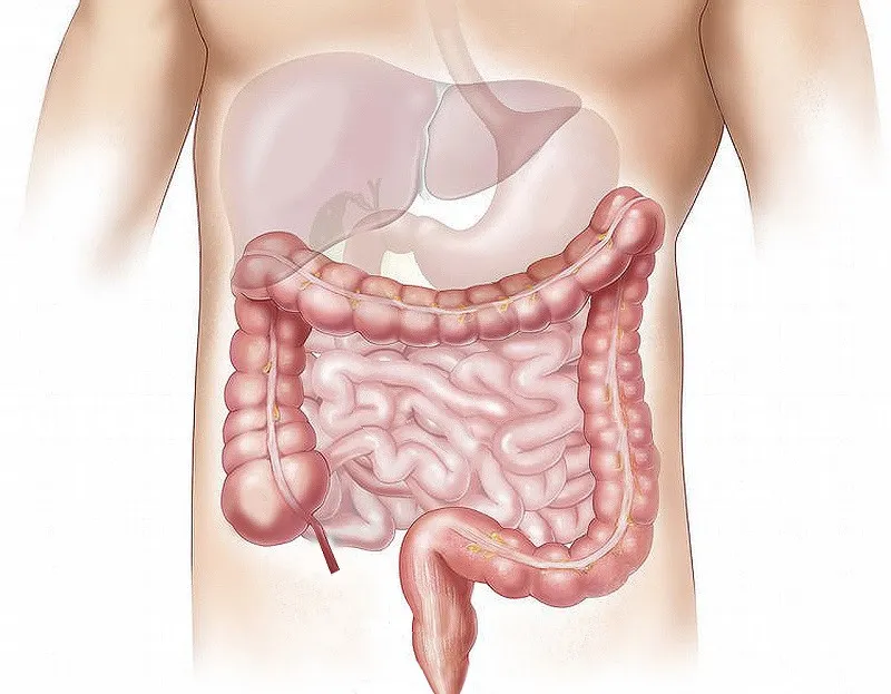 ¿Qué es el síndrome de colon irritable?