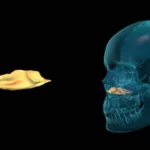 Huesos del macizo facial: cornete nasal inferior