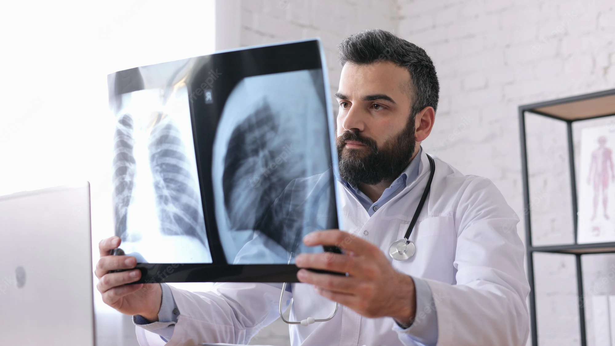 ¿Cómo se forman los abscesos pulmonares?