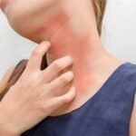 Abordaje urgente de pacientes con anafilaxis y reacciones alérgicas agudas.