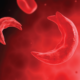 ¿Cuáles son las alteraciones de la hemoglobina en la anemia falciforme?