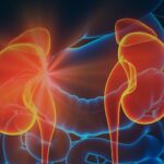 ¿Qué es la pielonefritis aguda?