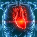 ¿Cómo se manifiestan los tumores cardiacos?