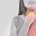 ¿Qué es la enfermedad por reflujo gastroesofágico?