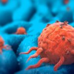 ¿Qué es una neoplasia? tumores malignos y benignos