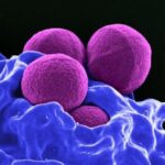 Toxinas estafilocócicas