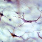 ¿Qué células hay en la dermis?