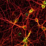 ¿Cuáles son los tipos de células del sistema nervioso?