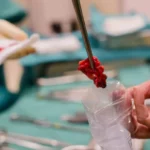 Técnicas para realizar una Biopsia