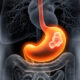 ¿Cuáles son los factores de riesgo para cáncer gástrico?