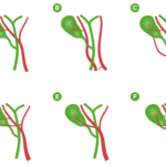 ¿Cuál es la arteria cística?