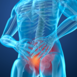 ¿Qué es la prostatitis bacteriana crónica?