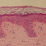 ¿Qué es la dermis?