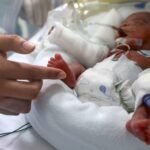 Diferencia entre sepsis precoz y tardía en el recién nacido.