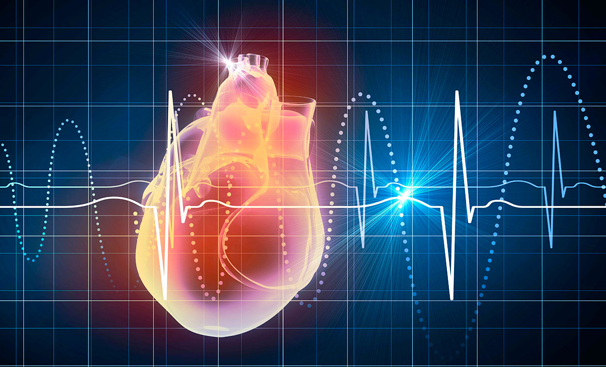 Utilidad del EKG y limitaciones
