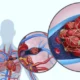 ¿Cuál es la causa del dolor torácico en la embolia pulmonar?