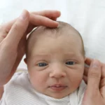 Exploración de la cabeza en el recién nacido