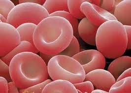 anemia microcítica hipocrómica
