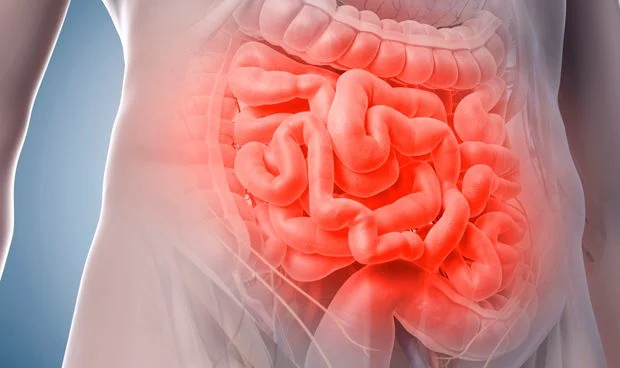 ¿Cuáles son las enfermedades intestinales inflamatorias?