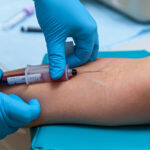 Diagnóstico de diabetes mellitus por laboratorio