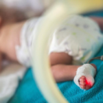 Complicaciones más importantes en el recién nacido prematuro