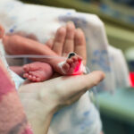 Microorganismos causales sepsis neonatal