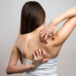 ¿Qué es la notalgia parestésica?