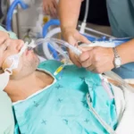 Lesiones traqueales relacionadas con la intubación