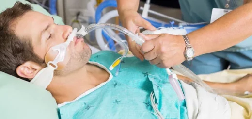 Lesiones traqueales relacionadas con la intubación