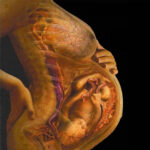 ¿Cuál es el papel de la leptina en el embarazo?