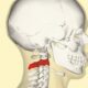 ¿Qué ligamentos hay entre el occipital y el axis?