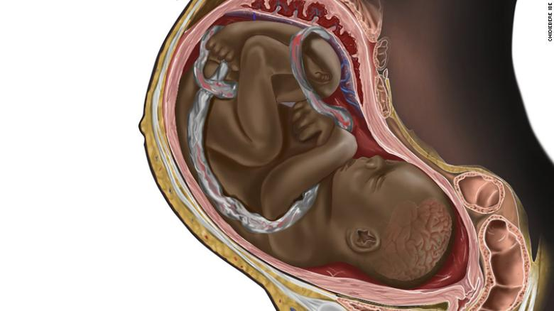 ¿Qué cambios hay en el miometrio antes del parto?