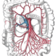 ¿Qué es la insuficiencia arterial visceral?