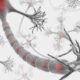 ¿Qué es la neuropatía periférica?