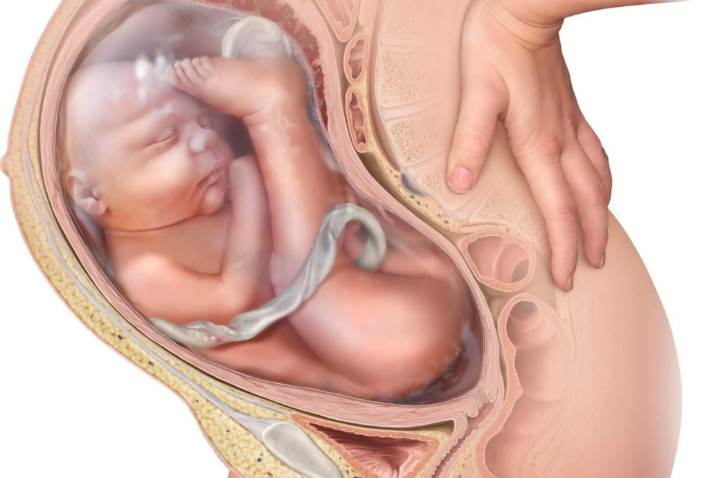Parto vaginal de feto en presentación pelviana