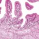 Anatomía microscópica de la vesícula biliar
