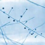 ¿Qué causa la blastomicosis?